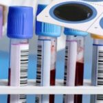 بخش سرولوژی آزمایشگاه دکتر صالحی