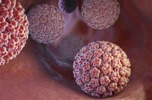 عفونت با HPV [زگیل تناسلی] سرطان دهانه رحم