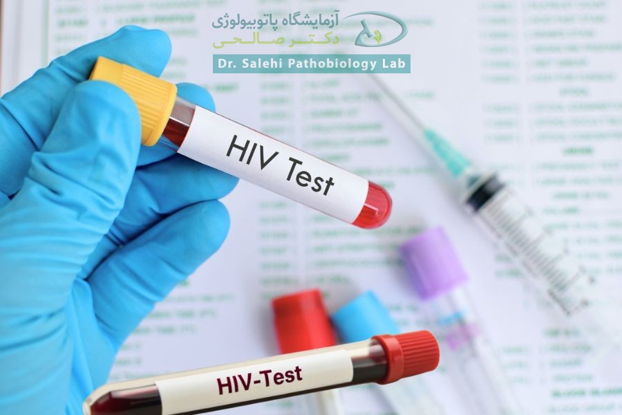 انجام آزمایش HIV