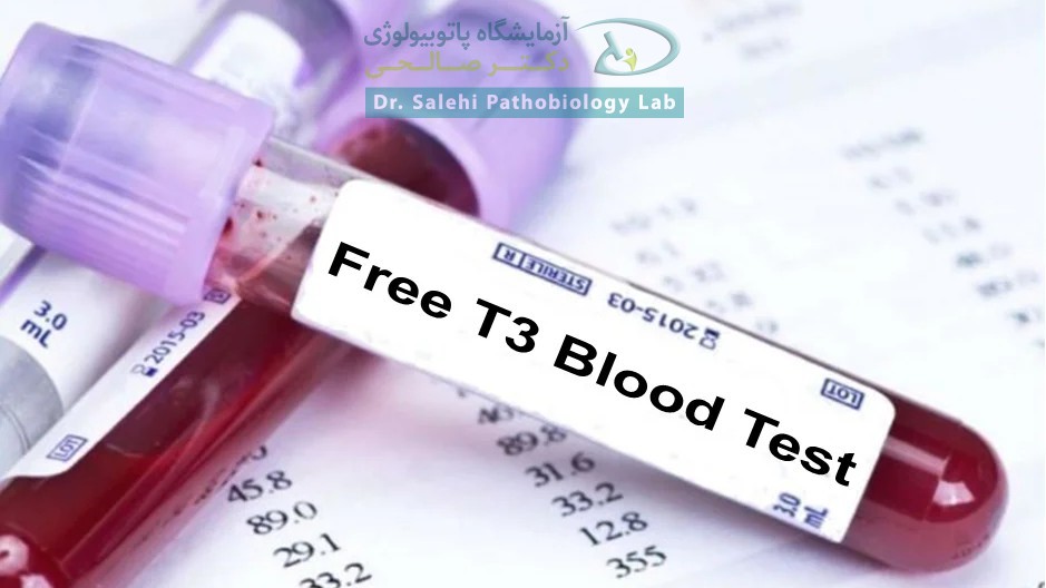 آزمایش Free T3 در آزمایشگاه دکتر صالحی شیراز