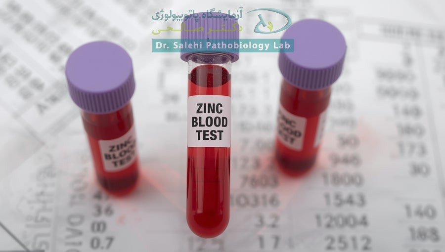 آزمایش Zinc (روی)
