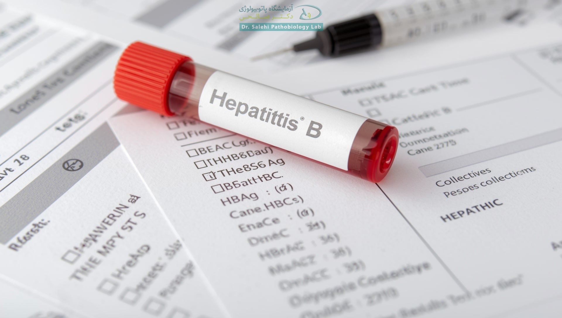 HBsAg آزمایش