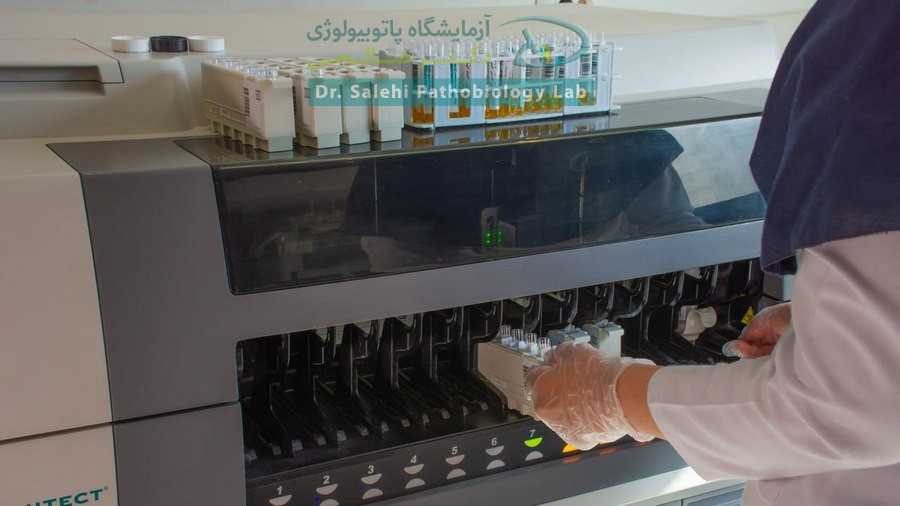 دستگاه های آزمایش هپاتیت در آزمایشگاه دکتر صالحی 