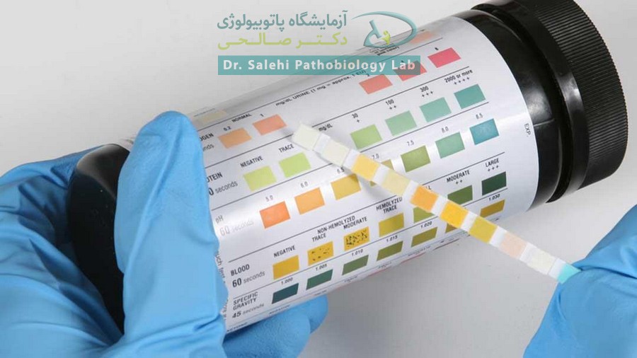 نوار تست ادرار