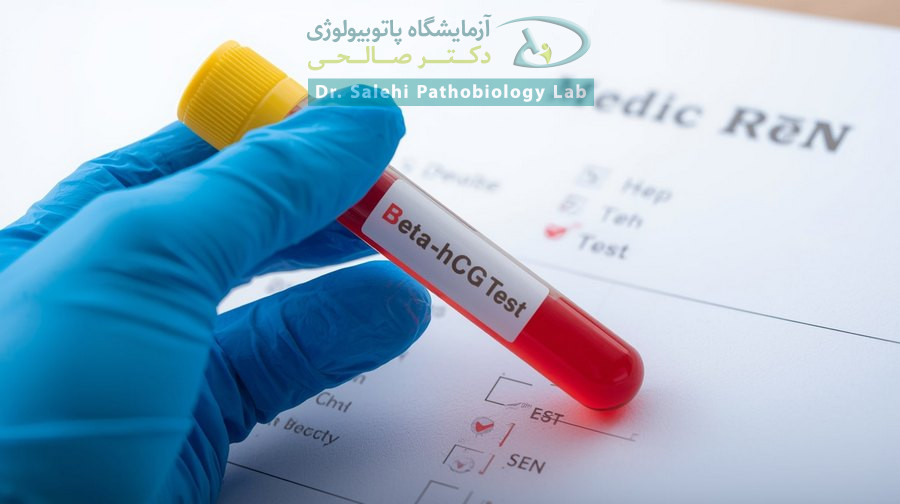 Beta HCG Test آزمایش خون بارداری
