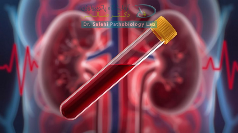 علائم نارسایی کلیه در آزمایش خون