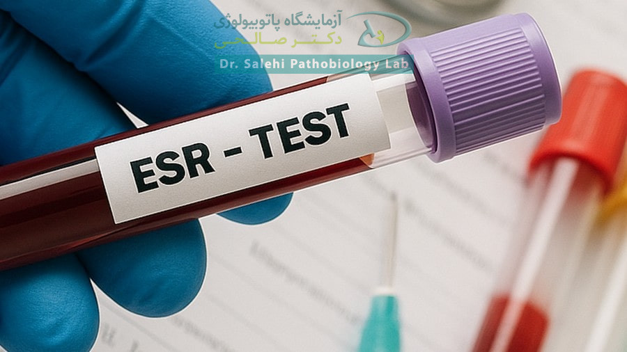 آزمایش ESR