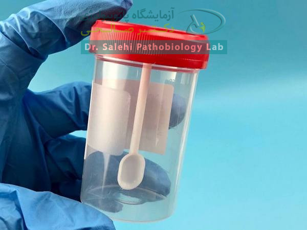 ظرف جمعآوری نمونه مدفوع