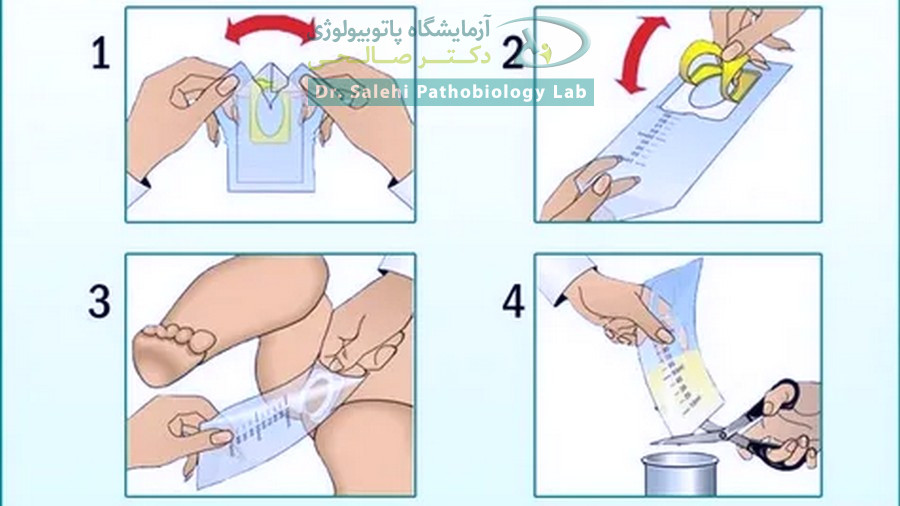 روش صحیح جمع‌آوری نمونه ادرار نوزاد