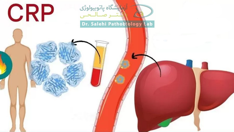 CRP پروتئینی است که در کبد تولید می‌شود