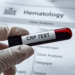 CRP در آزمایش خون چیست؟