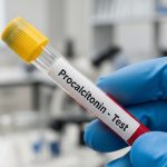 PCT در آزمایش خون چیست؟