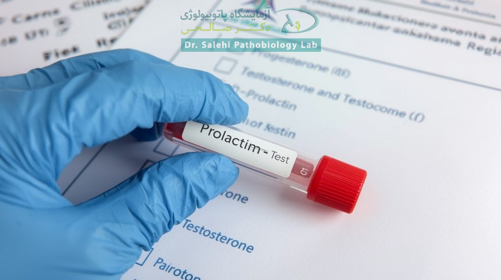 آزمایش پرولاکتین چیست