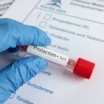 آزمایش پرولاکتین چیست