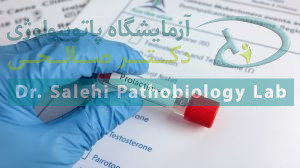 آزمایش پرولاکتین چیست