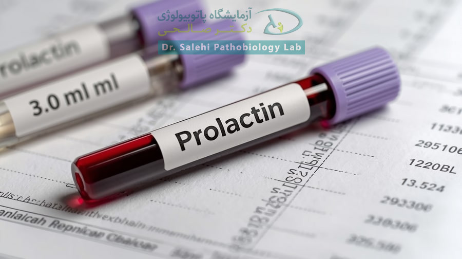 آزمایش پرولاکتین چیست و چرا تجویز میشود؟