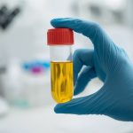 نحوه نگهداری نمونه ادرار در منزل