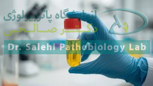 نحوه نگهداری نمونه ادرار در منزل