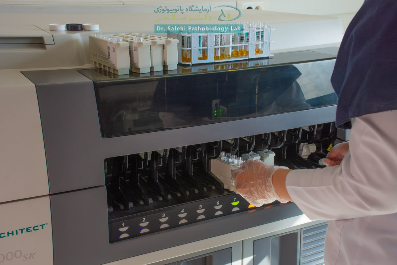 تجهیزات پیشرفته بخش هورمونی آزمایشگاه دکتر صالحی
