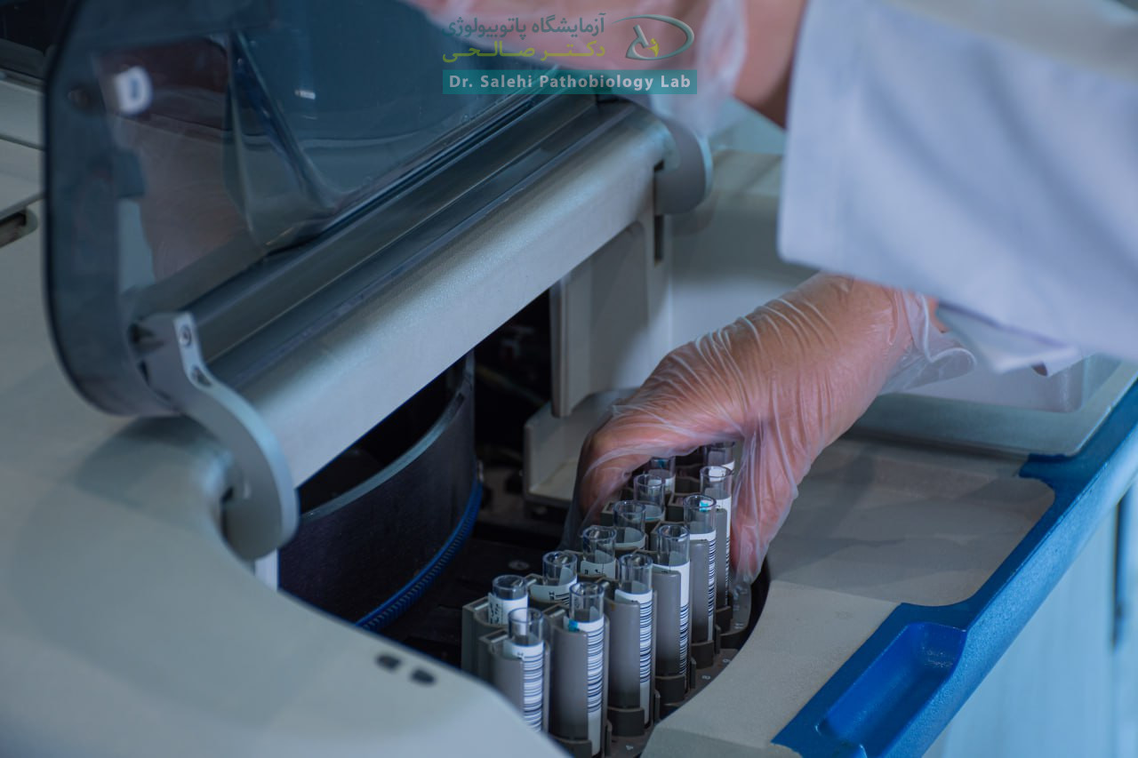 تجهیزات بسیار پیشرفته بخش هورمونی آزمایشگاه دکتر صالحی