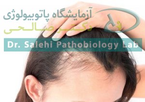 ریزش مو و بی‌حالی؛ آیا ویتامین D بدن شما در سطح خطرناک است؟