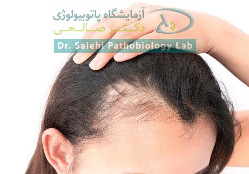 ریزش مو و بی‌حالی؛ آیا ویتامین D بدن شما در سطح خطرناک است؟